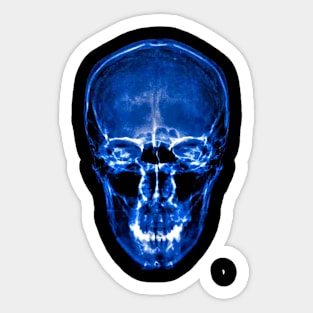 Skull coloured blue skull X-ray , Sticker